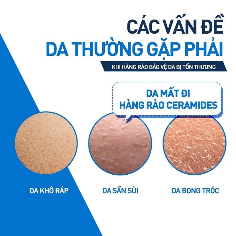Sữa Dưỡng Chống Nắng Cerave Hỗ Trợ Phục Hồi Da Facial Moisturising Lotion AM 52ml