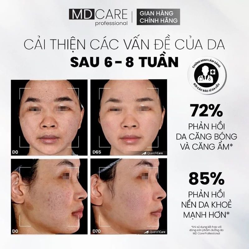 Sữa Rửa Mặt Dạng Gel Làm Sạch Sâu MD CARE Professional Mandelic Acid 5% Gel Cleanser