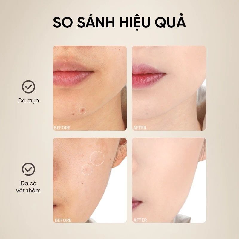 Bộ Cọ Che Khuyết Điểm Amortals Hai Đầu Chuyên Dụng Dual-Head Seamless Dotting Brushdual