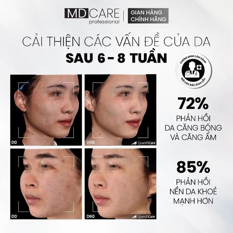 Tẩy Tế Bào Chết Căng Bóng, Cấp Ẩm Và Làm Sáng Da MD CARE Professional Mande Exfo-For All Skin Types