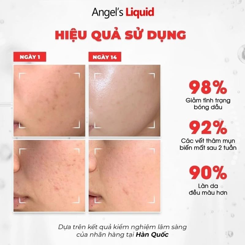 Kem Dưỡng Angel's Liquid Hỗ Trợ Dưỡng Sáng, Kiểm Soát Dầu Glutathione Plus Niacinamide Cica Cream 50ml