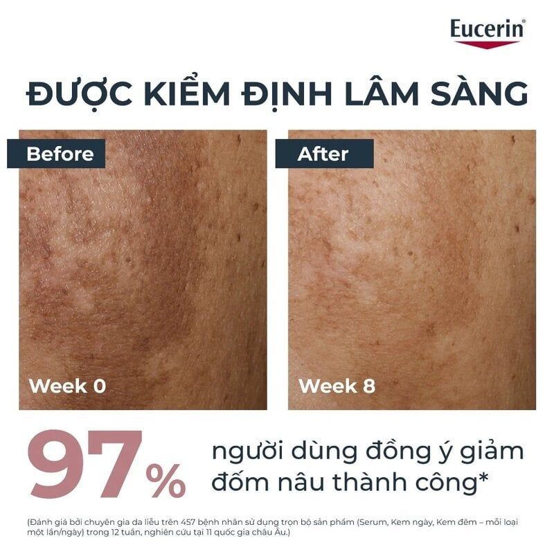 Kem Dưỡng Eucerin Ban Đêm Hỗ Trợ Giảm Thâm Nám & Làm Sáng Da Eucerin Even Skin Spotless Brightening Night 50ml