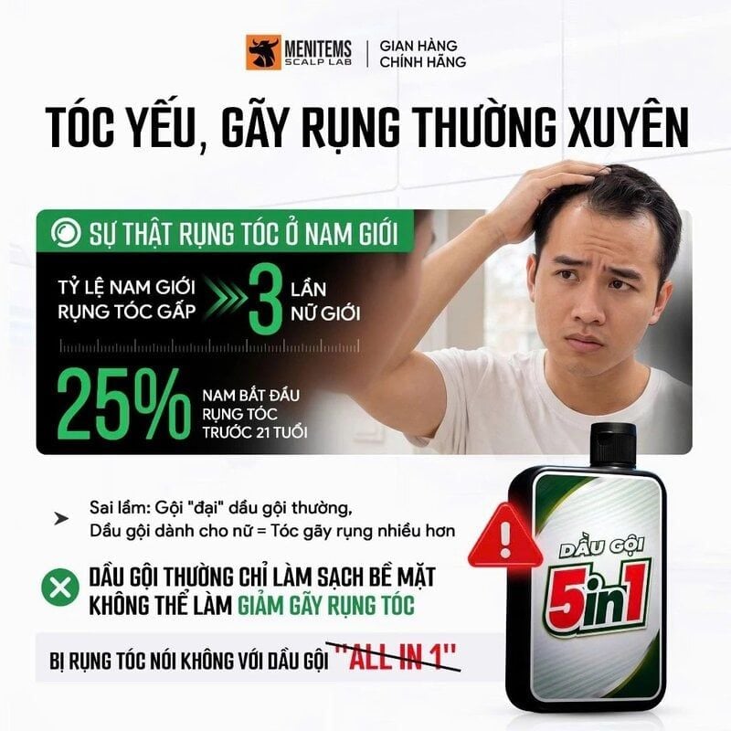Dầu Gội Menitems Hỗ Trợ Giảm Rụng Tóc Táo Xanh Green Apple Hair Fall Control 300ml
