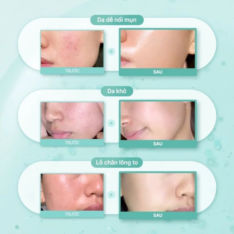 Serum Some By Mi Làm Dịu Da Mụn, Hỗ Trợ Phục Hồi PDRN Spirulina Soothing Repair Serum 50ml