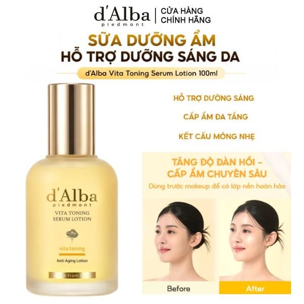  Sữa Dưỡng Ẩm d'Alba Hỗ Trợ Dưỡng Sáng Da Vita Toning Serum Lotion 100ml 