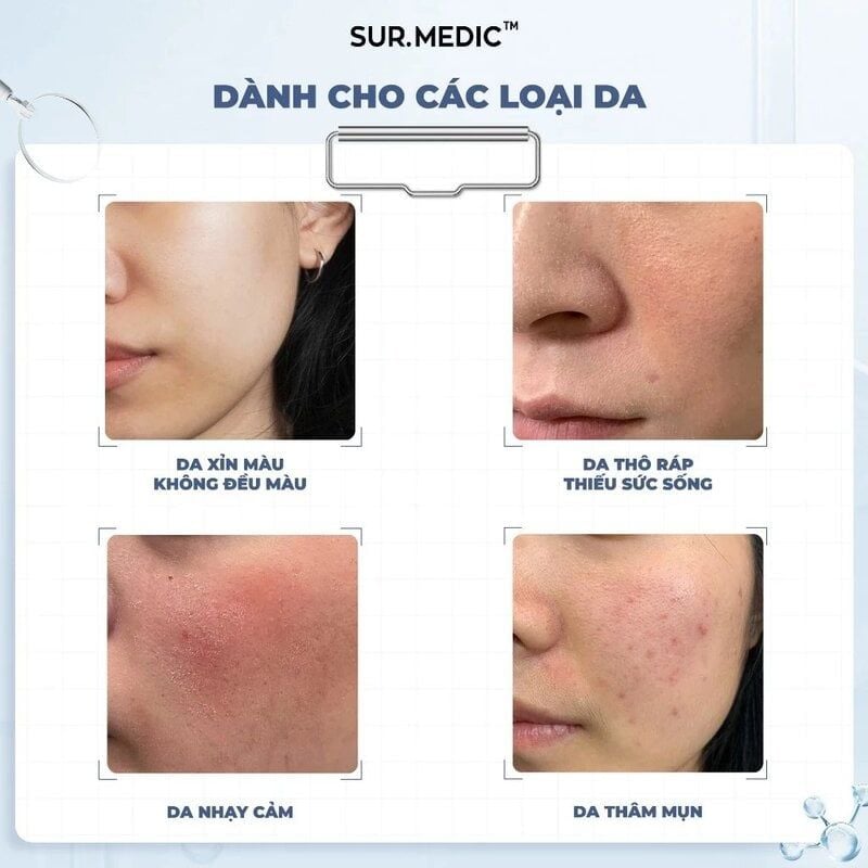 Kem Dưỡng Sur.Medic+ Hỗ Trợ Dưỡng Trắng, Căng Bóng Da Super Glutathione 1000™ Enriched Cream 50ml