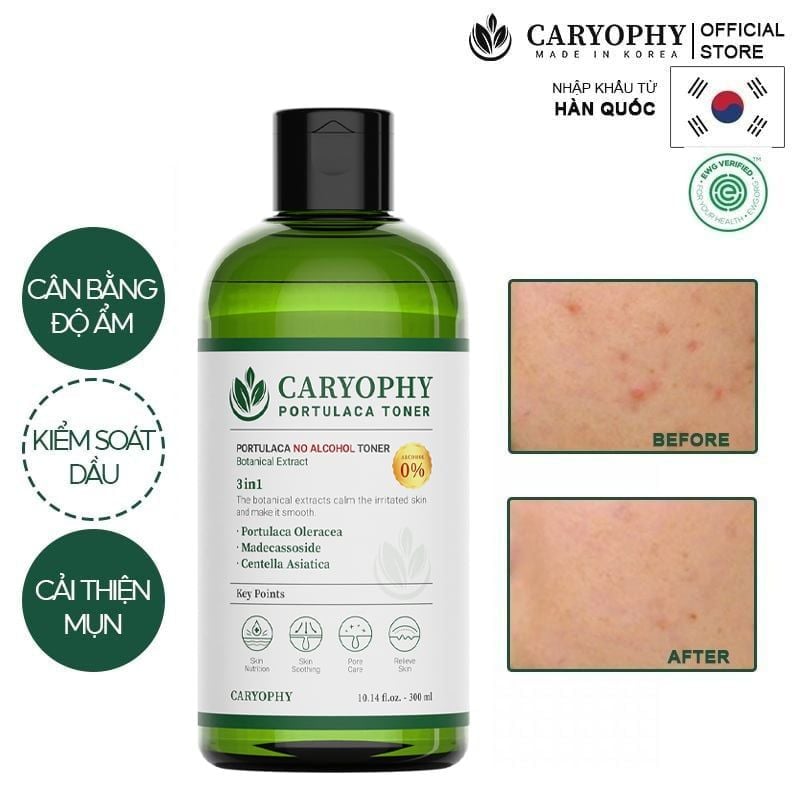 Nước Hoa Hồng Caryophy Chăm Sóc Da Dầu Mụn Portulaca Toner 300ml