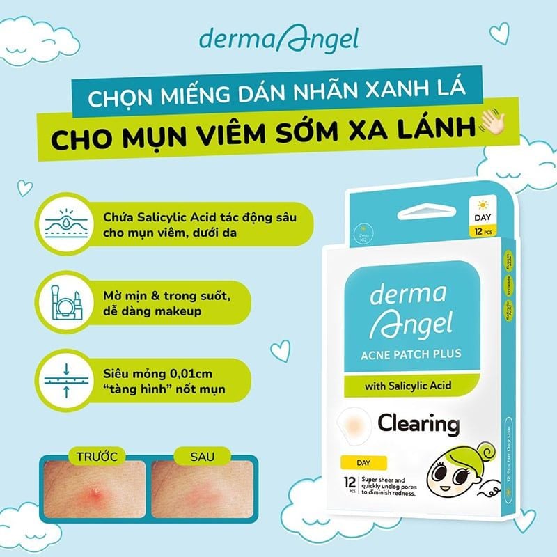 Miếng Dán Mụn Derma Angel Ban Ngày Hỗ Trợ Giảm Viêm Mụn Acne Patch Plus With Salicylic Acid Clearing (12 miếng)