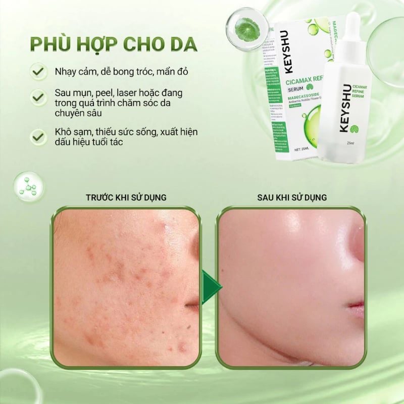 Serum Keyshu Chiết xuất Rau Má, Hỗ Trợ Làm Dịu, Phục Hồi Da Cicamax Refine Serum 25ml