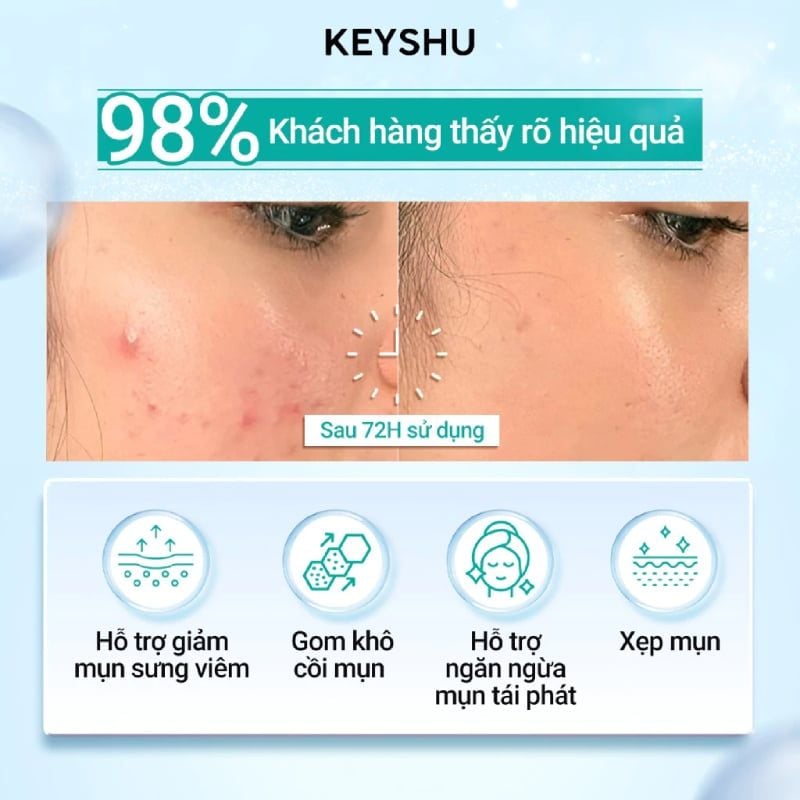 Serum Keyshu Hỗ Trợ Giảm Mụn, Làm Dịu Da Triki Plus 20ml