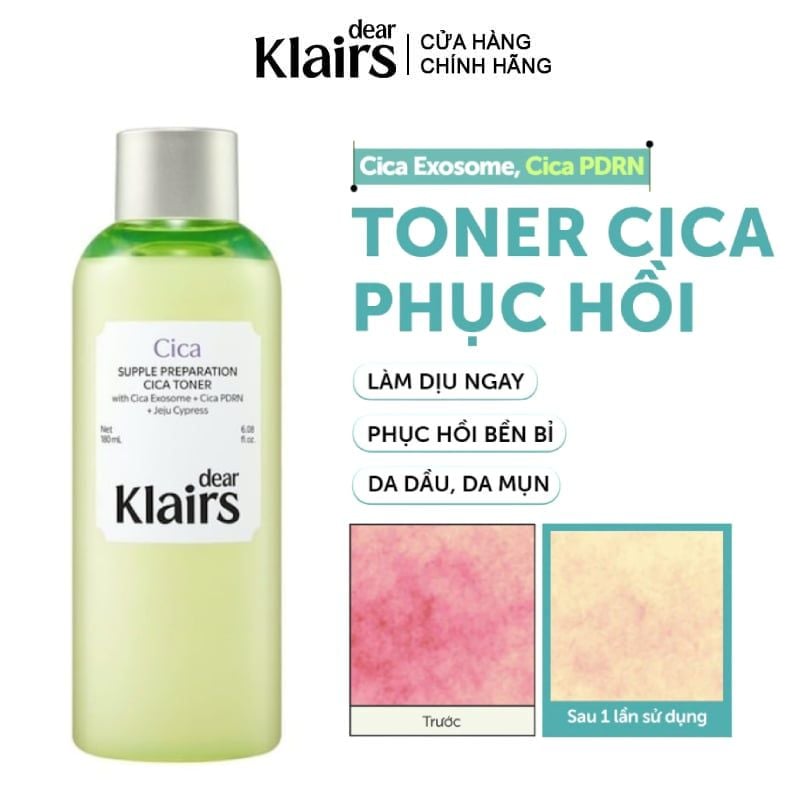 Nước Hoa Hồng Dear Klairs Làm Dịu, Hỗ Trợ Phục Hồi Da Supple Preparation Cica Toner 180ml