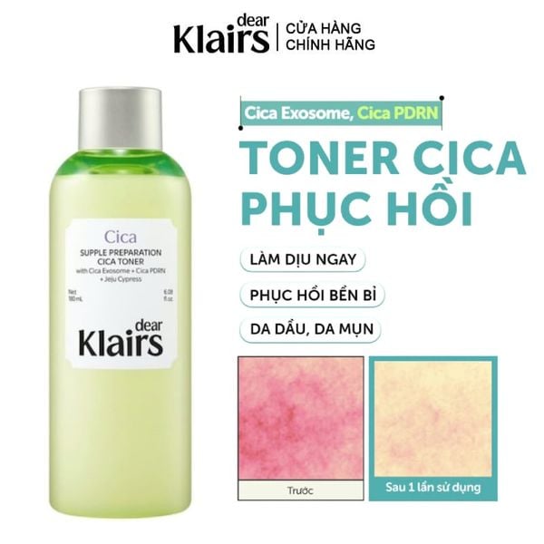  Nước Hoa Hồng Dear Klairs Làm Dịu, Hỗ Trợ Phục Hồi Da Supple Preparation Cica Toner 180ml 