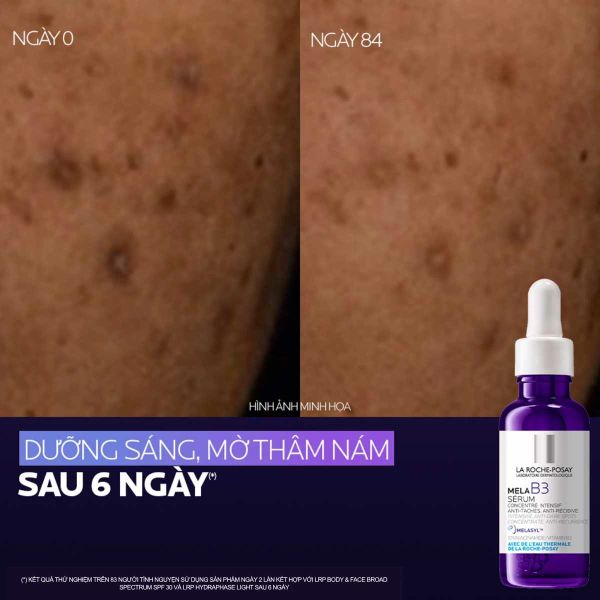 Tinh chất mờ thâm nám, da sáng & đều màu La Roche-Posay Mela B3 Serum