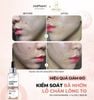 Tinh chất dưỡng ẩm, giảm mụn & sáng da InoPharm Pure Elements Facial Serum with 10% Niacinamide + 1% Zinc
