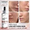 Tinh chất dưỡng ẩm, giảm mụn & sáng da InoPharm Pure Elements Facial Serum with 10% Niacinamide + 1% Zinc