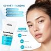 Kem ngăn ngừa mụn và tái tạo da Synergy Therm Acne Clear Facial Cream