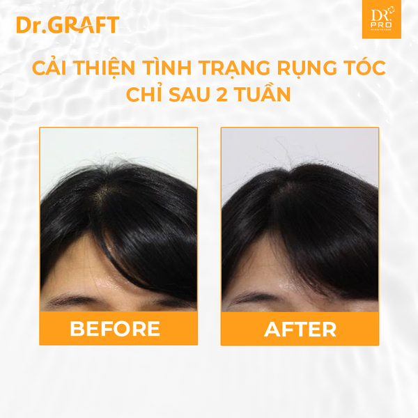 Xịt dưỡng da đầu giúp mọc tóc Dr.GRAFT Scalp Tonic