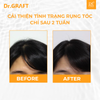 Xịt dưỡng da đầu giúp mọc tóc Dr.GRAFT Scalp Tonic