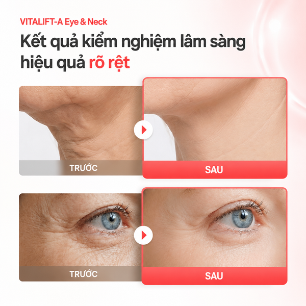 Kem dưỡng trẻ hoá, mờ nhăn cổ và mắt Dr.Different Vitalift-A Eye & Neck Retinal 0.025% Night Treatment Cream