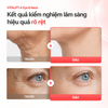 Kem dưỡng trẻ hoá, mờ nhăn cổ và mắt Dr.Different Vitalift-A Eye & Neck Retinal 0.025% Night Treatment Cream