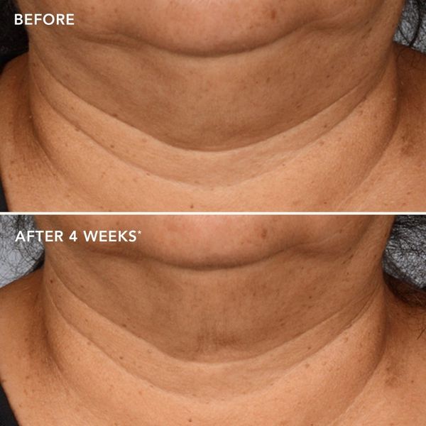 Kem trẻ hoá & săn chắc vùng cổ IMAGE Skincare The MAX Neck Lift