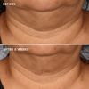 Kem trẻ hoá & săn chắc vùng cổ IMAGE Skincare The MAX Neck Lift