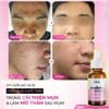 Tinh chất giảm mụn & mờ thâm Synergy Therm 10% Azelaic Acid Serum
