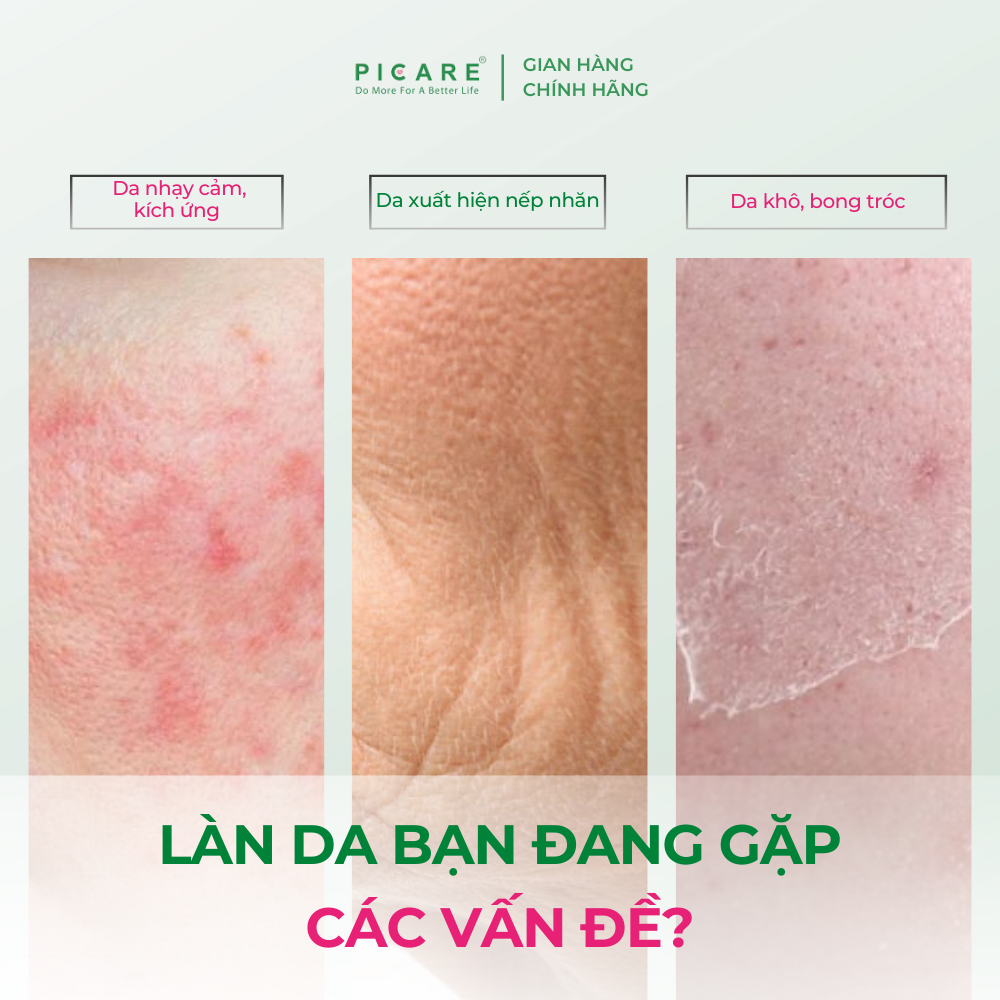 [ 03/2027 ] Tinh chất giúp cải thiện nếp nhăn và cân bằng hệ vi sinh Sebamed PRO! Intensive Serum 30ml