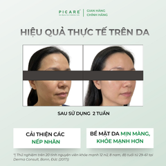 [ 03/2027 ] Tinh chất giúp cải thiện nếp nhăn và cân bằng hệ vi sinh Sebamed PRO! Intensive Serum 30ml