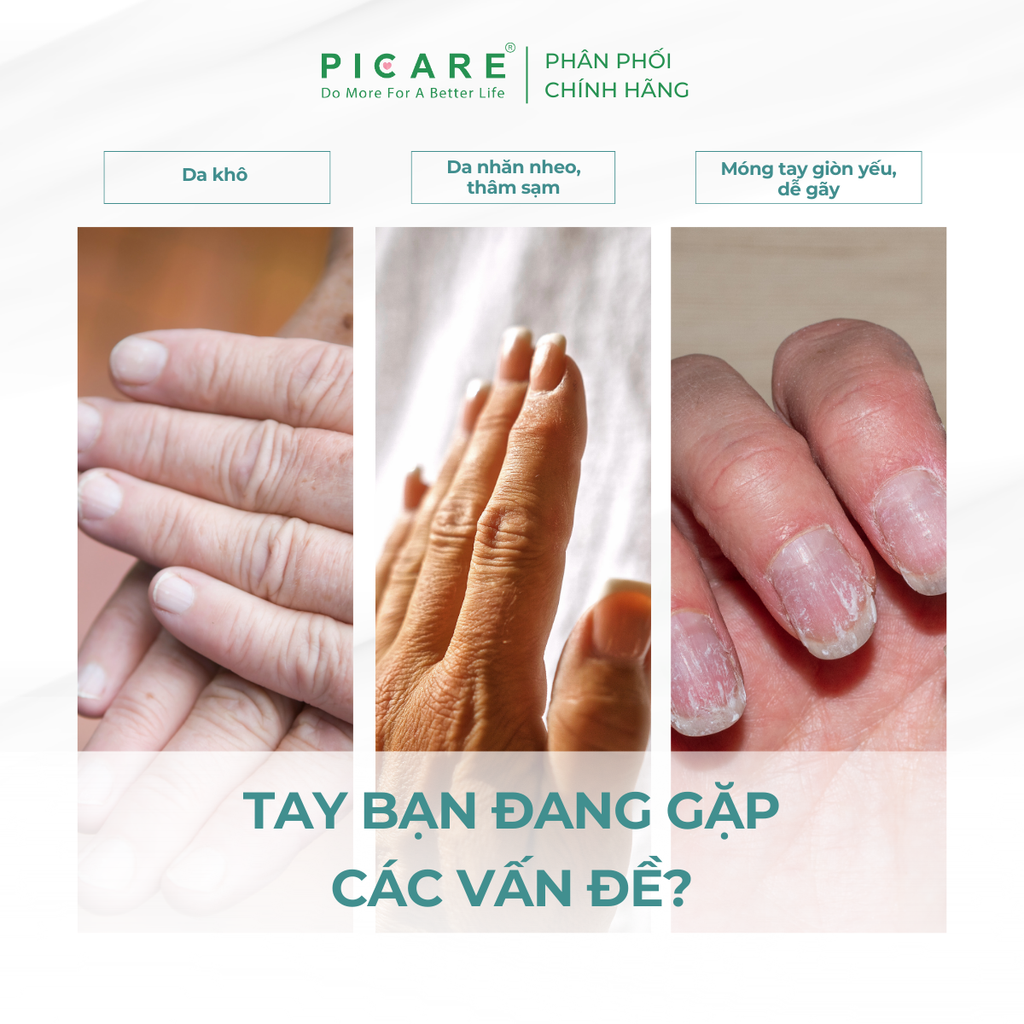 Kem dưỡng ẩm cho da tay và móng tay Pax Moly Vitamin Collagen Hand & Nail Repair Cream 100ml