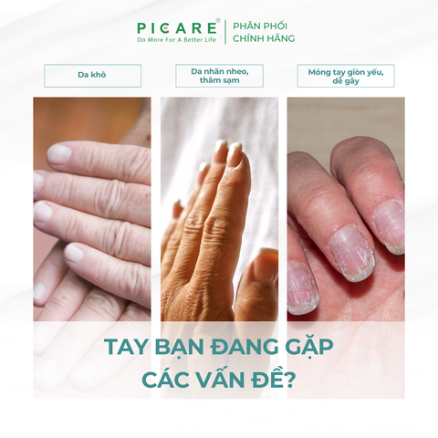 Kem dưỡng ẩm cho da tay và móng tay Pax Moly Vitamin Collagen Hand & Nail Repair Cream 100ml