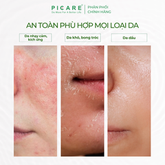 Sữa rửa mặt tạo bọt Rau má giúp làm sạch sâu và giảm bã nhờn Pax Moly Perfect Cica Foam Cleanser 100ml