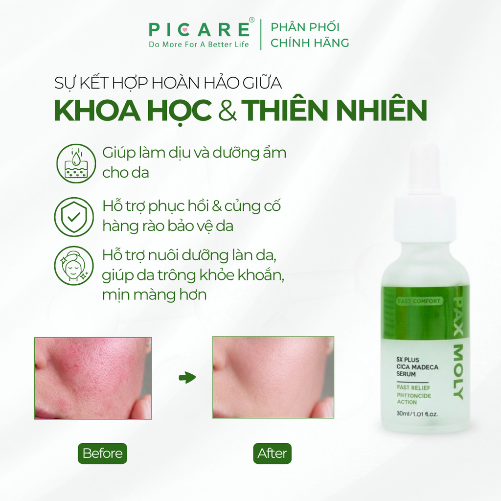 Tinh chất Rau má giúp làm dịu, dưỡng ẩm và hỗ trợ phục hồi da Pax Moly 5x Plus Cica Madeca Serum 30ml