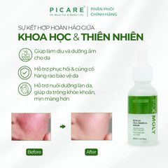 Tinh chất Rau má giúp làm dịu, dưỡng ẩm và hỗ trợ phục hồi da Pax Moly 5x Plus Cica Madeca Serum 30ml