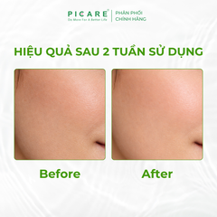 Nước hoa hồng rau má giúp làm dịu và dưỡng ẩm cho da Pax Moly Dr. JK MULTI Solution Vitamin Cica Toner 160ml