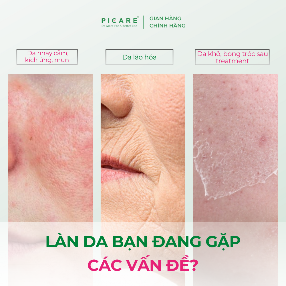 [10/2026 ] Tinh chất làm sáng, dưỡng ẩm và cân bằng hệ vi sinh Sebamed PRO! Hydro Serum 30ml