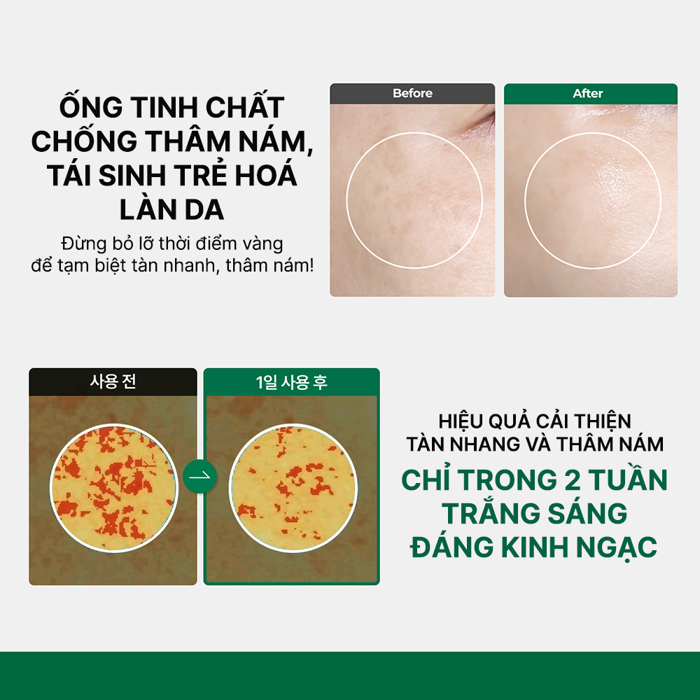 Tinh Chất Giảm Đốm Nâu, Giúp Đều Màu Da Easydew DW-EGF Melatoning Oneday Ampoule (1ml*7 ống)