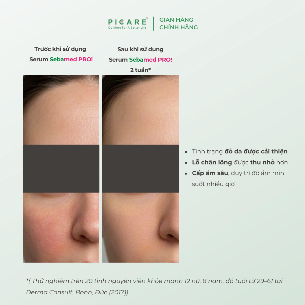 [10/2026 ] Tinh chất làm sáng, dưỡng ẩm và cân bằng hệ vi sinh Sebamed PRO! Hydro Serum 30ml