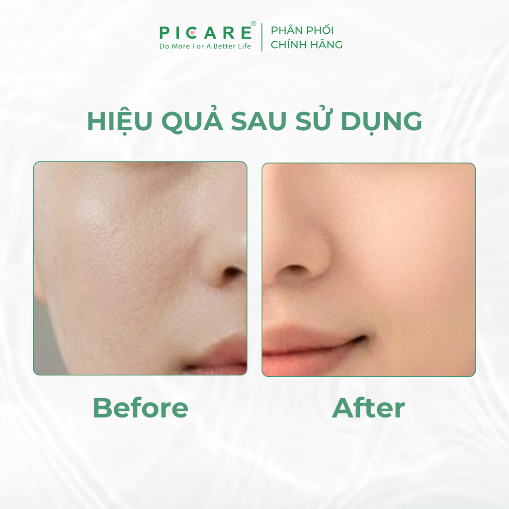 Kem dưỡng rau má giúp cấp ẩm sâu làm dịu và phục hồi cho da Pax Moly Centella Cica 5X Repair Cream 100g