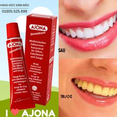 Kem đánh răng y tế loại bỏ cao răng và viêm lợi - AJONA Stomaticum, 25ml