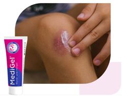 MediGel - Gel điều trị các vết thương cấp tính và bỏng - Schnelle Wundheilung 20gr