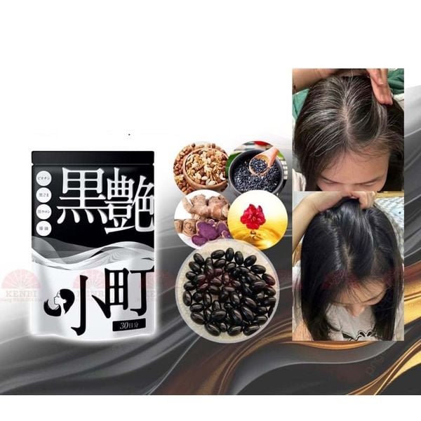 Viên uống hỗ trợ đen tóc, ngừa tóc bạc sớm Kurotsuya Komachi