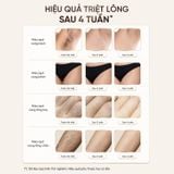 Máy Triệt Lông Lạnh Masuto IPL SkinSense AI - Nhận Diện Màu Da Thông Minh