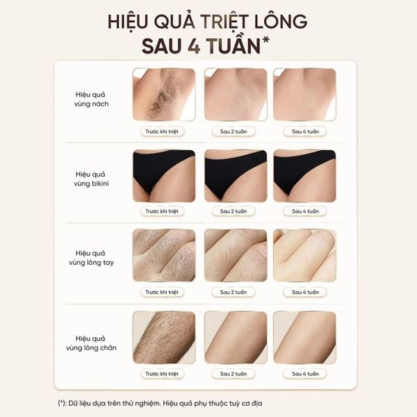 Máy Triệt Lông Lạnh Masuto IPL SkinSense AI - Nhận Diện Màu Da Thông Minh