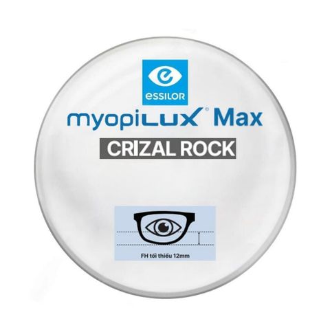  Tròng Kính Kiểm Soát Cận Thị Trẻ Em Essilor Myopilux Max Crizal Rock & Crizal Prevencia Lab Nước Ngoài – Chính Hãng 