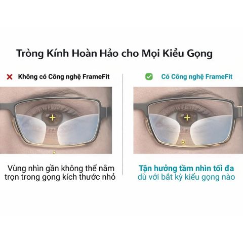  Zeiss Smartlife Plus Tròng Kính Đa Tròng với Lớp Phủ Cao Cấp DuraVision Gold 