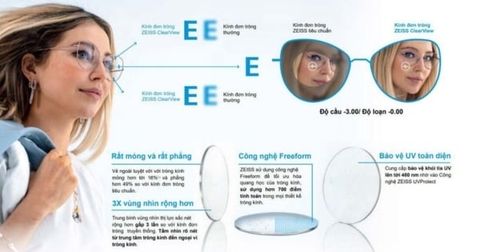  Zeiss ClearView DuraVision® Gold BlueGuard – Tròng Kính Đơn Tròng Đánh Thế Hệ Mới Cho Thời Đại Số 