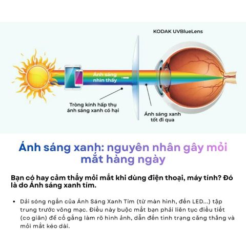  Kodak 1.74 UVBlue – Tròng Kính Chống Ánh Sáng Xanh Siêu Mỏng 
