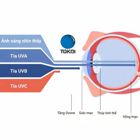  Tokai 1.70 Sereno IS SPS UV400 – Kính Đa Tròng Nhật Bản Siêu Mỏng 