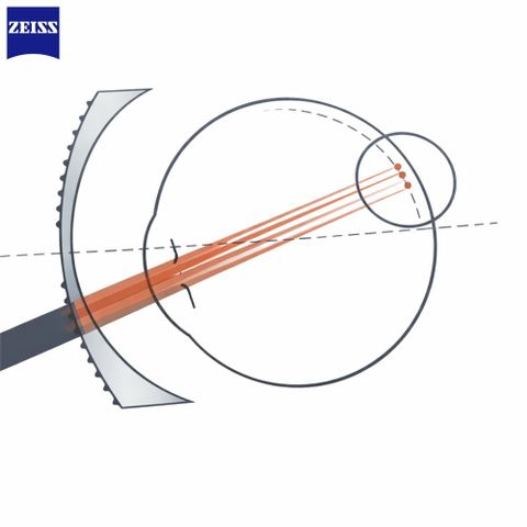 Zeiss MyoCare – Tròng Kính Trẻ Em Kiểm Soát Cận Thị Thế Hệ Mới 